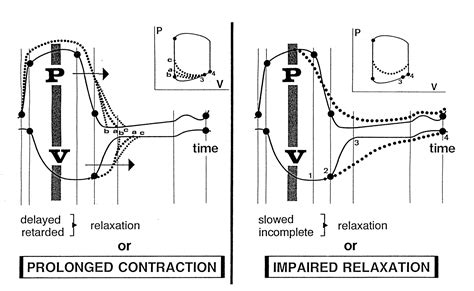 is impaired lv relaxation dangerous